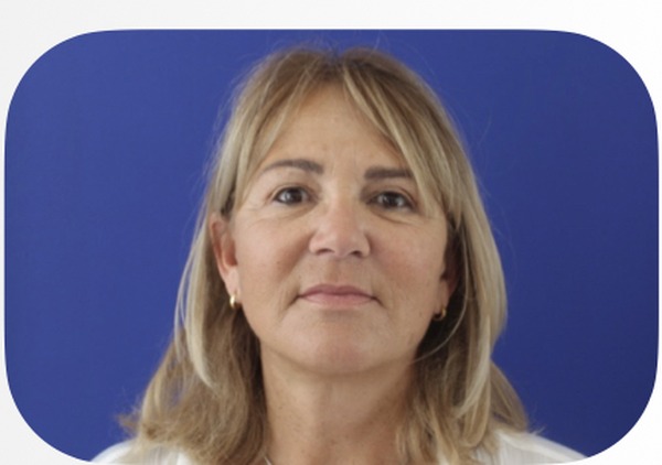 Après lifting facial liposuccion cervicale 1 an — Patiente 4 — Dr Germain Marseille