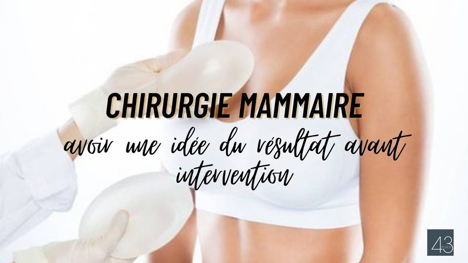 Vidéo du Dr Germain sur la projection du résultat avant une augmentation mammaire