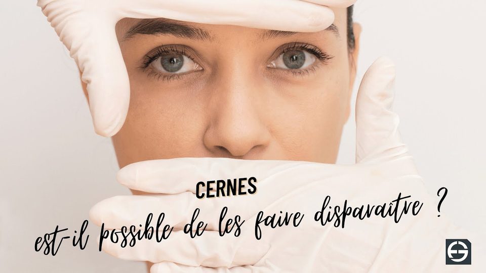 Vidéo du Dr Germain sur le traitement des cernes