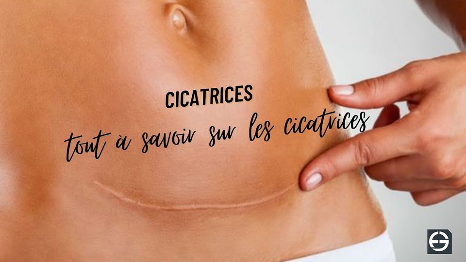 Vidéo du Dr Germain sur les cicatrices post-opératoires